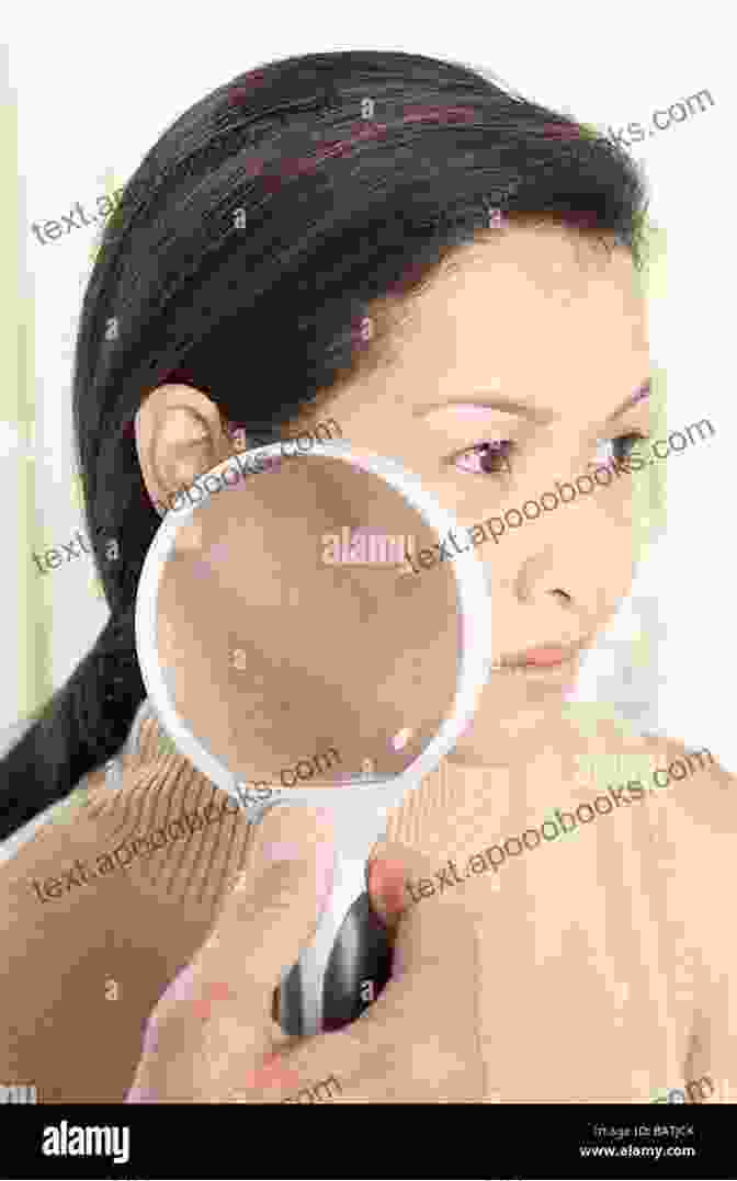 A Person Using A Magnifying Glass To Examine Their Skin Non Melanoma Skin Cancer And Cutaneous Melanoma: Surgical Treatment And Reconstruction