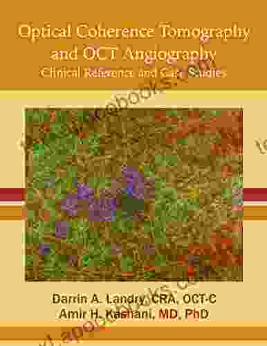 Optical Coherence Tomography and OCT Angiography